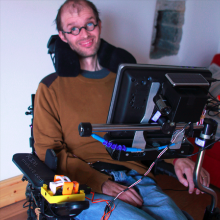 渐冻人创客用3D打印技术开发眼球控制轮椅