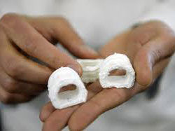 3D打印的气管夹板拯救多名患儿生命