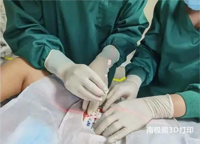 河南省肿瘤医院核医学科成功实施河南省首例3D打印模板引导粒子植入术