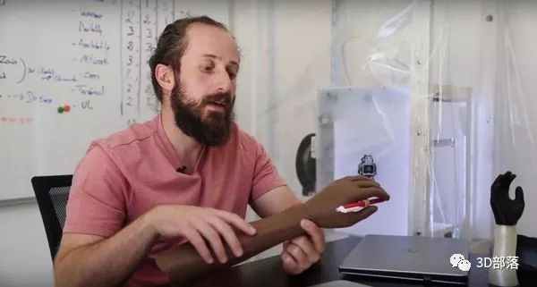3D打印假肢如何帮助一家医院治疗叙利亚战争难民？