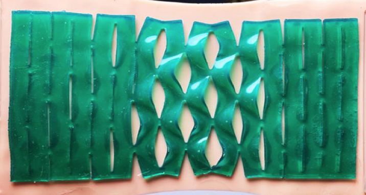 麻省理工学院使用3D打印技术开发出类似剪纸造型的粘胶绷带