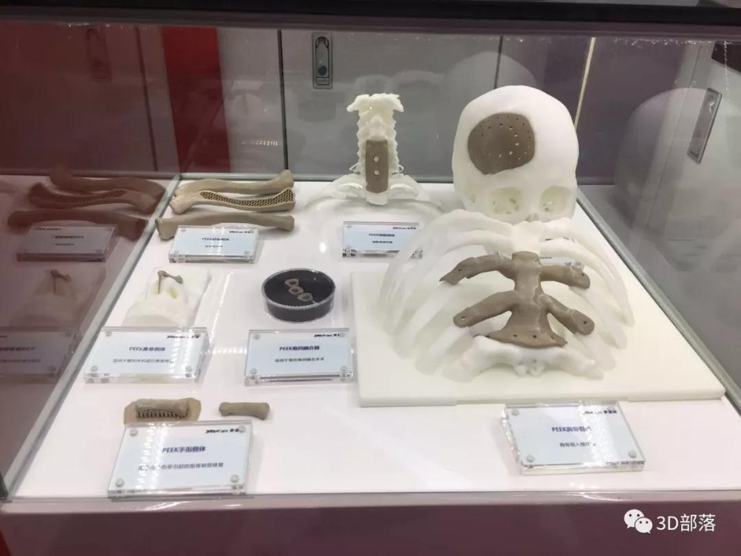 科技改变医疗的5大方式：AI、纳米、VR、3D打印和机器人