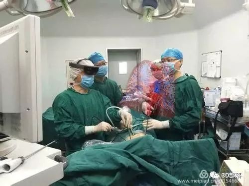 郑州大学附属郑州中心医院完成郑州市第一例增强现实3d可视化指导下手术