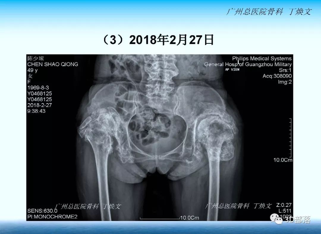 广总丁焕文主任诚邀疑难病例全国范围大会诊、大讨论！